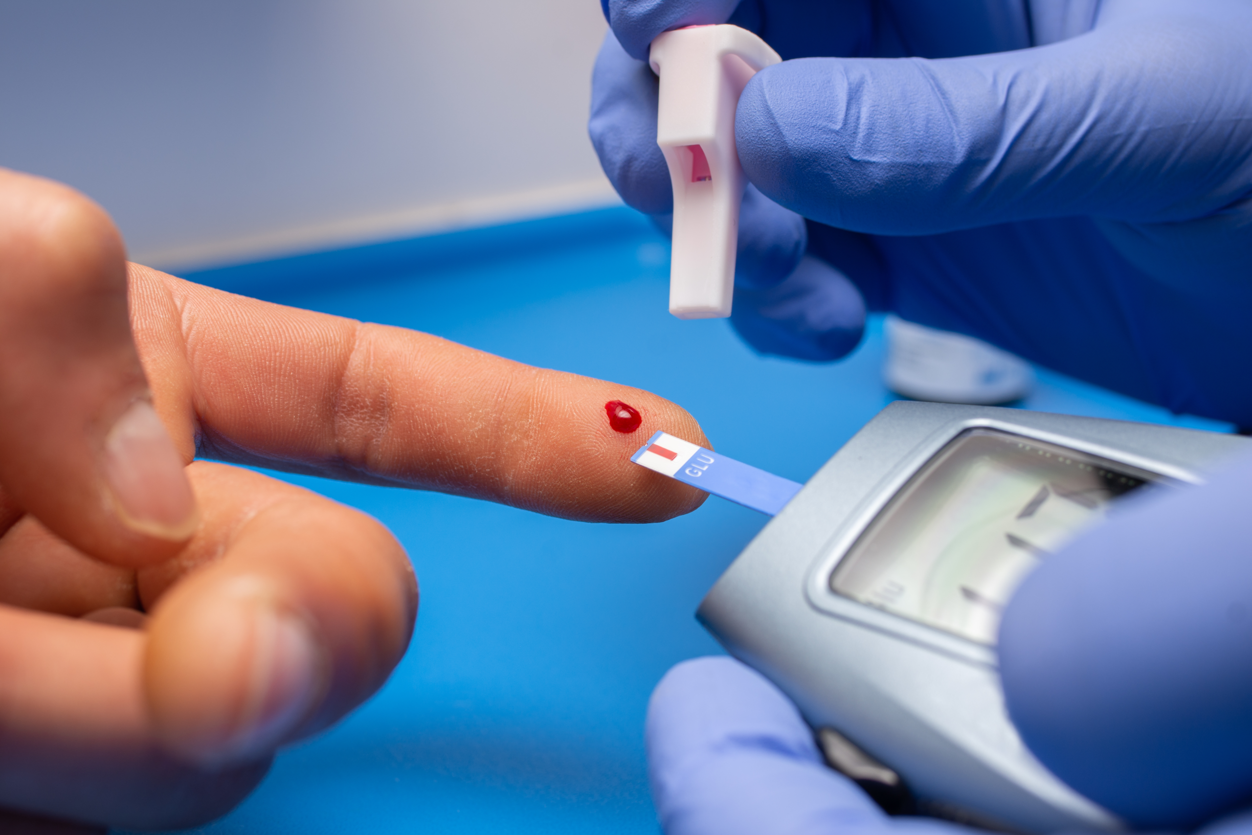 blood glucose (sugar) test